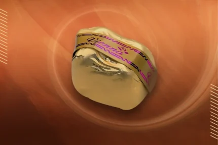 لوز روشيه